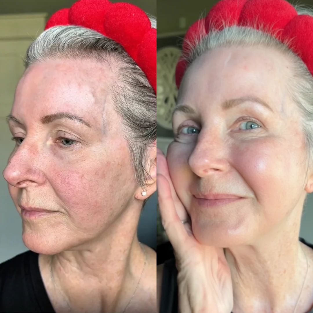 Bio-Collagen Real Deep Face Mask